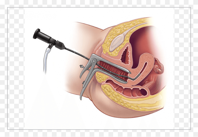 943x630 In This Department All Laparoscopic Surgeries Are Hysteroscopy, Teeth, Mouth, Lip HD PNG Download