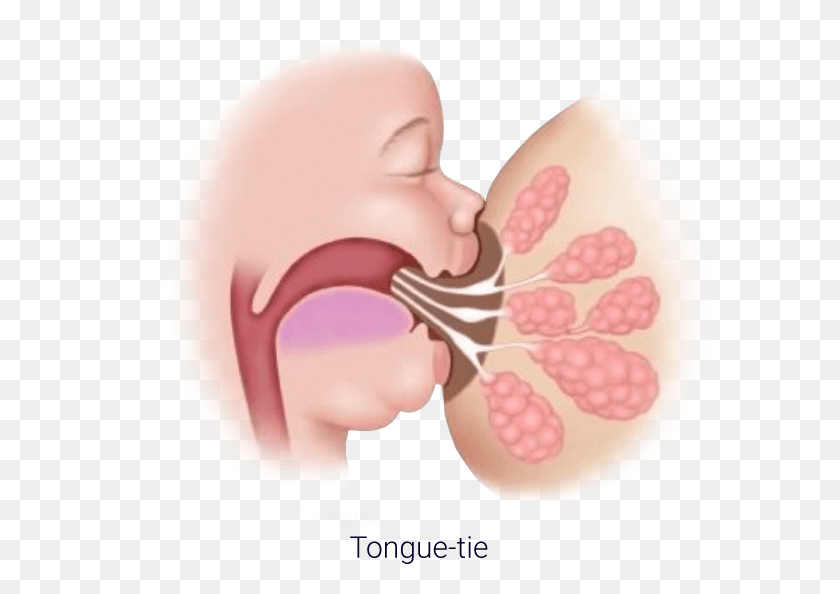634x534 Infant Tongue Tie Treatment Tongue Tie, Person, Human, Ear HD PNG Download