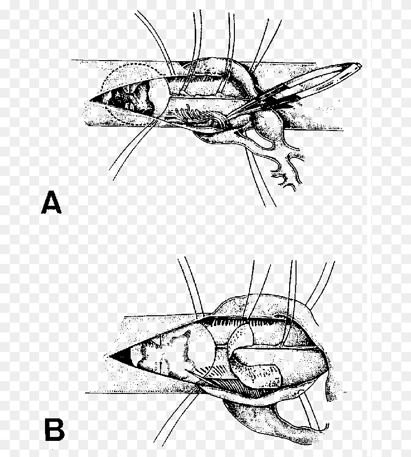 675x935 Insect, Gray Sticker PNG