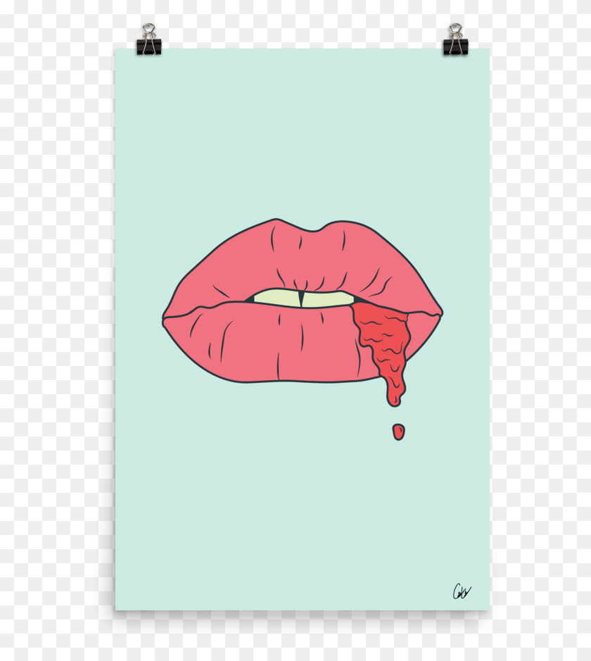 585x879 Kiss These Lips Print Illustration, Mouth, Lip, Teeth HD PNG Download
