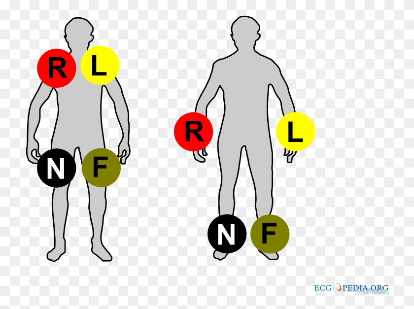 738x567 Limb Leads Ecg Limb Leads Colour, Person, People, Sport HD PNG Download