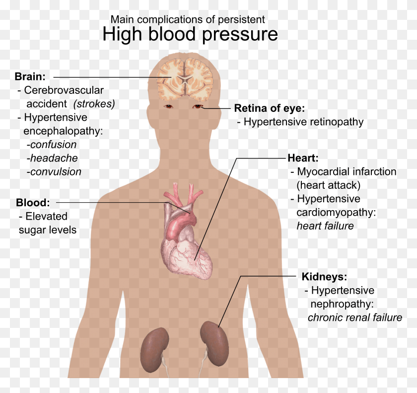 2538x2379 Main Complications Of Persistent High Blood Pressure High Blood Pressure Complications, Person, Human, Back HD PNG Download