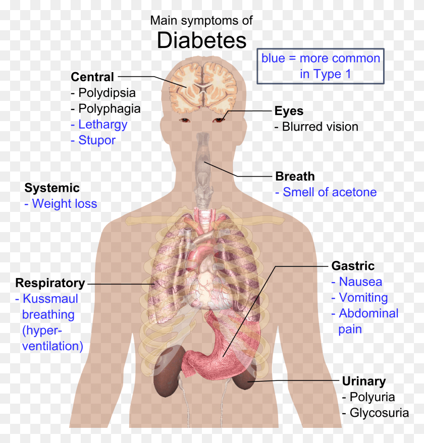 2216x2324 Main Symptoms Of Diabetes, Diagram, Plot, Neck HD PNG Download
