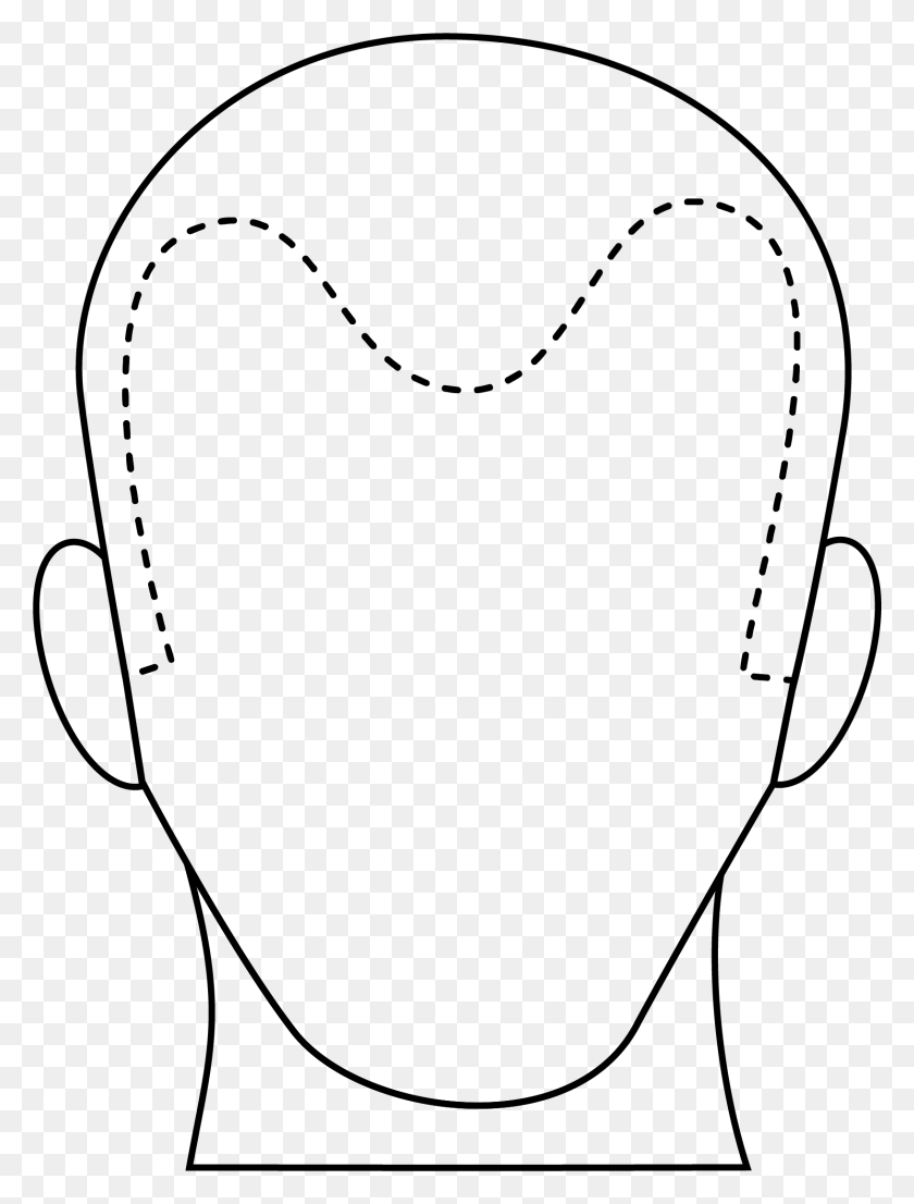 1632x2189 Male Hair Loss Coloriage Oliver Et Compagnie, Clothing, Apparel, Heart Descargar Hd Png