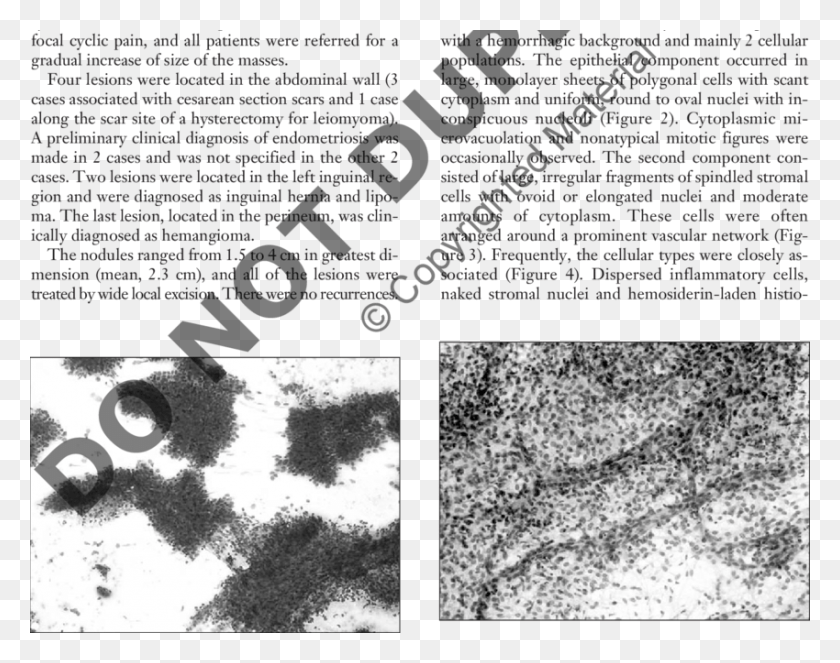 850x658 Markedly Cellular Smear Pap Test, Poster, Advertisement, Collage HD PNG Download