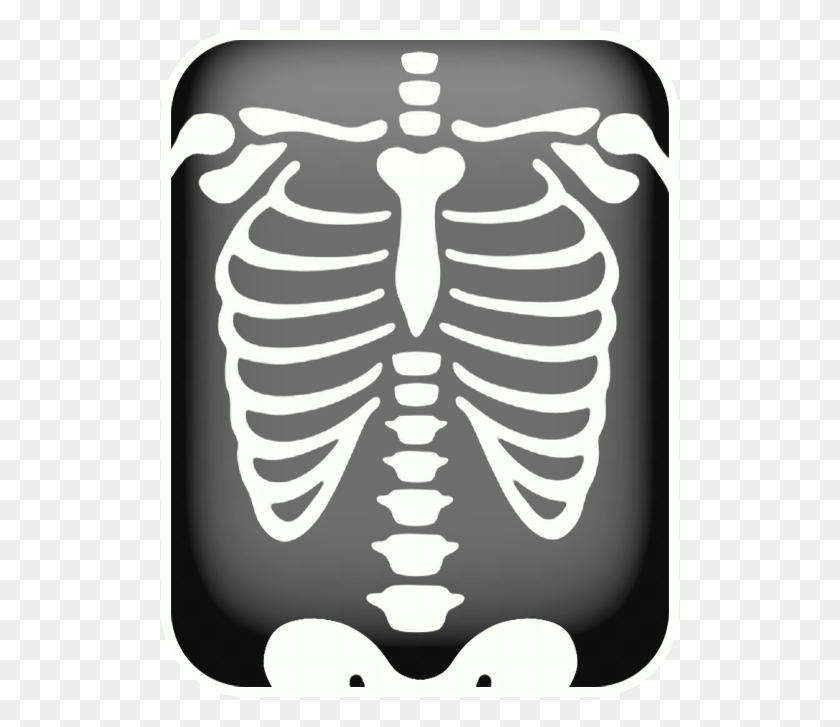 518x667 Mdico Hospital Doentes E Etc Chest X Ray Cartoon, Rug, Skeleton, Stencil HD PNG Download