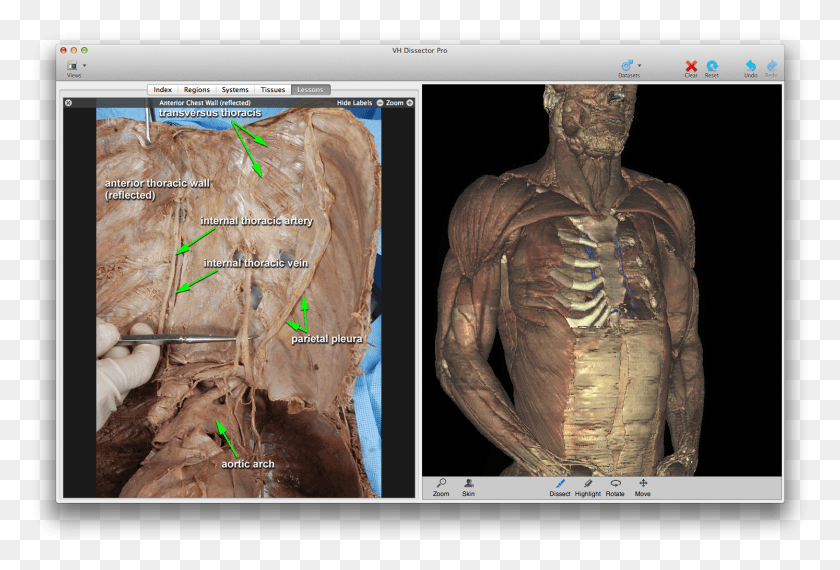 1494x977 Medical Education Software, Cow, Cattle, Mammal HD PNG Download