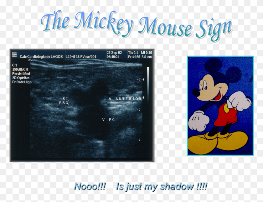 1254x942 Mickey Mouse Sign Mickey Mouse, Text, Outdoors, Outer Space HD PNG Download