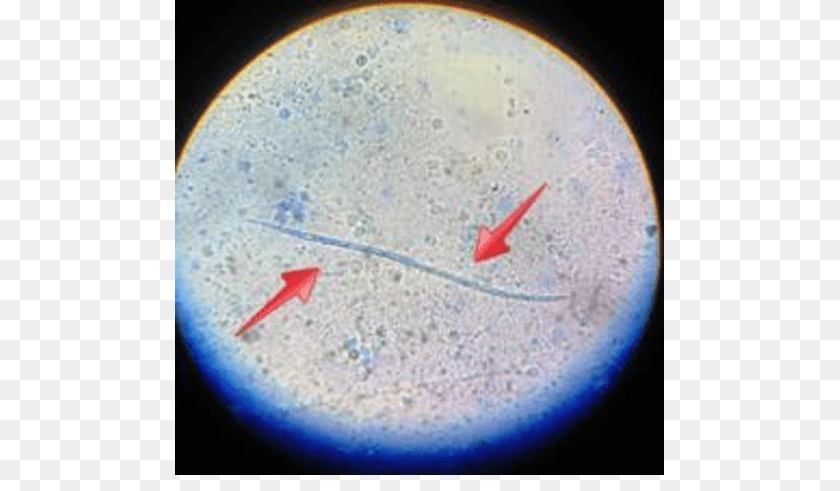 722x491 Microfilariae In The Modified Knott Test Smear Fig Adult, Sphere, Astronomy, Moon, Nature Transparent PNG