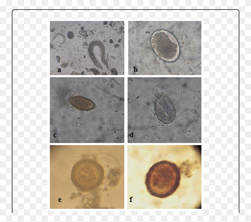 763x682 Microscopic Images Of Different Parasites Observed Pest, Coin, Money, Fossil HD PNG Download