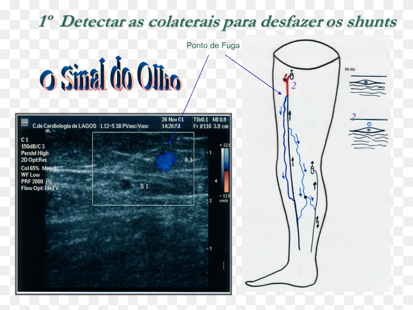 1368x1000 O Sinal Do Olho Mickey Mouse Sign In Varicose Vein, Plot, Diagram, Measurements HD PNG Download
