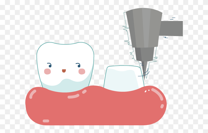 638x475 Once This Is Complete Cerec Uses Diamond Burs To Create Illustration, Cushion, Pillow, Snowman HD PNG Download