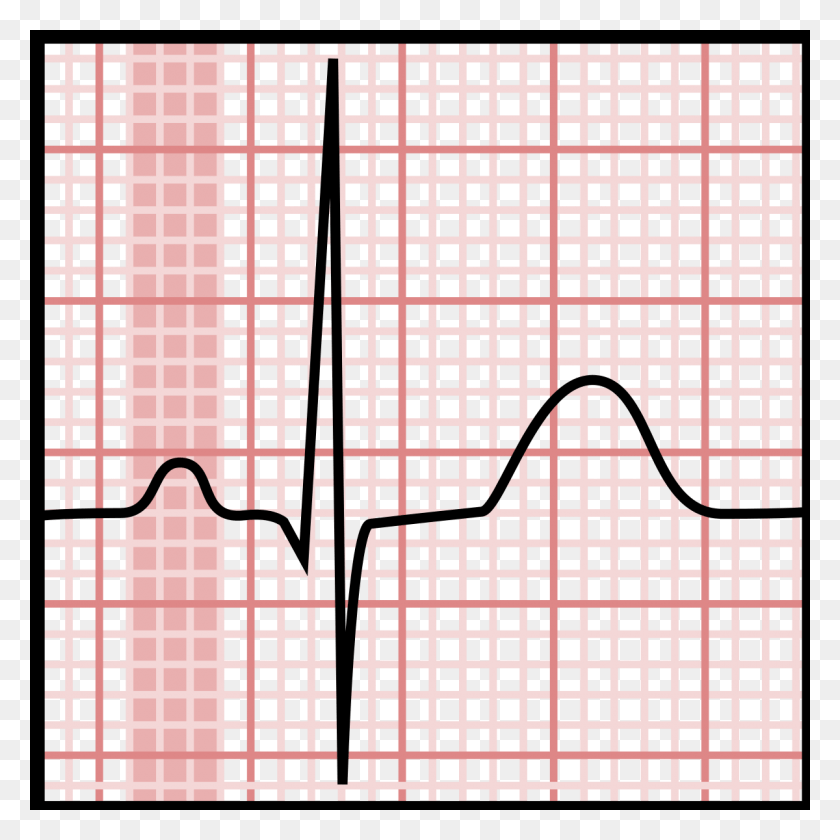 1200x1200 P Wave Normal P Wave In Ecg, Pattern, Grille, Texture HD PNG Download