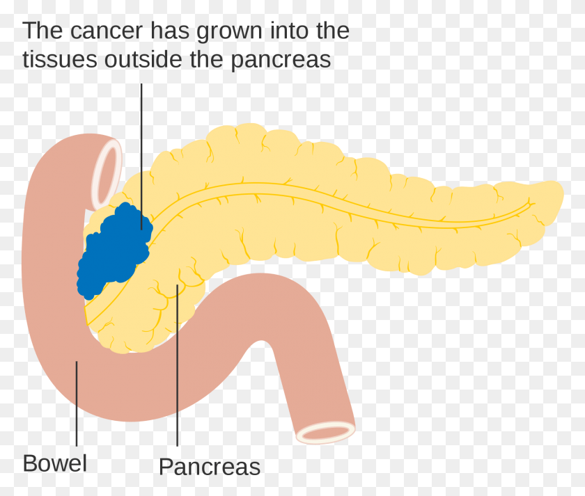 1697x1422 Pancreas Diagram Cancer De Pancreas, Animal, Reptile, Fungus HD PNG Download