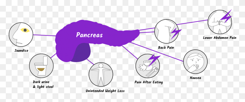 992x369 Pancreatic Cancer Symptoms Diagram, Sport, Sports, Building HD PNG Download