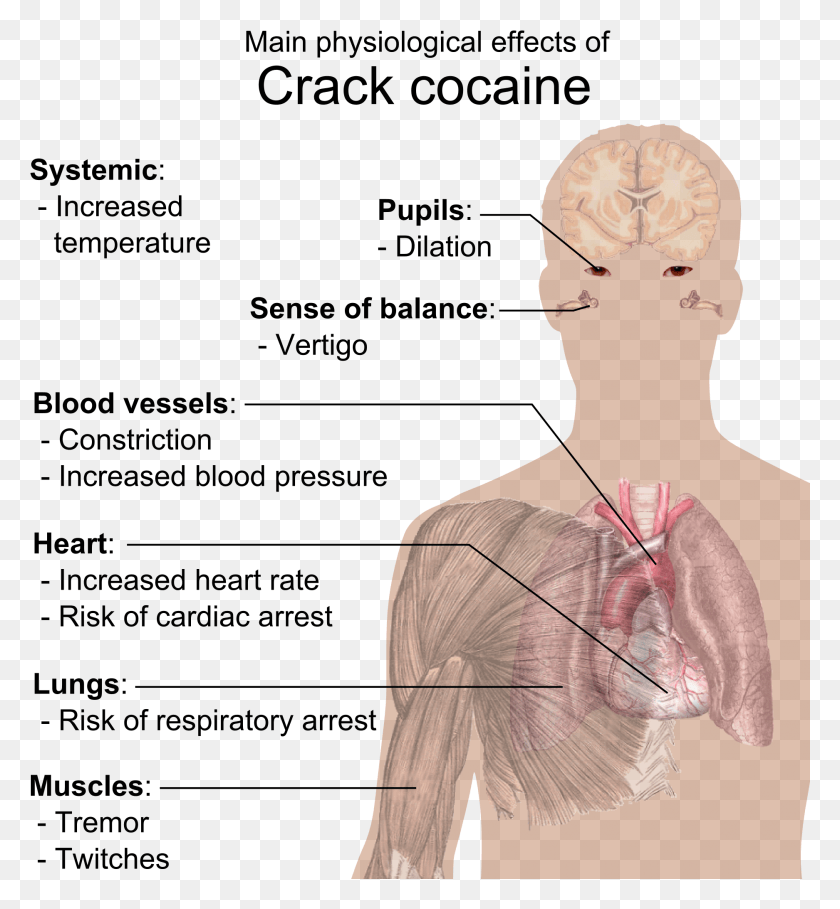 1875x2043 Physiological Effects Of Crack Cocaine Crack Does To Your Body, Neck, Person, Human HD PNG Download