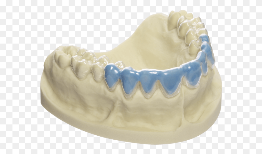 585x435 Отбеливающие Протезы Produktbild, Челюсть, Зубы, Рот Png Скачать