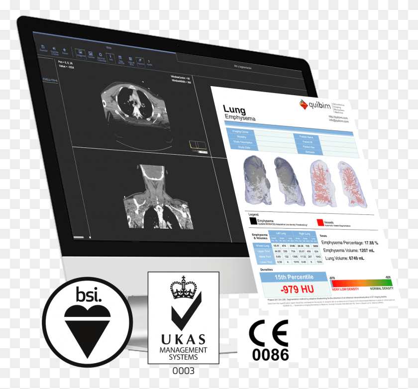 1417x1313 Quibim Ce Mark Ukas Quality Management, X-ray, Medical Imaging X-ray Film, Ct Scan HD PNG Download