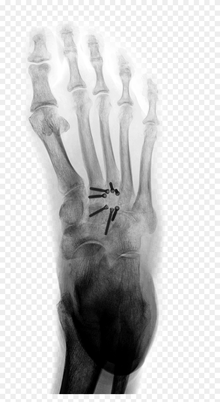 761x1471 Radiography, X-ray, Medical Imaging X-ray Film, Ct Scan HD PNG Download