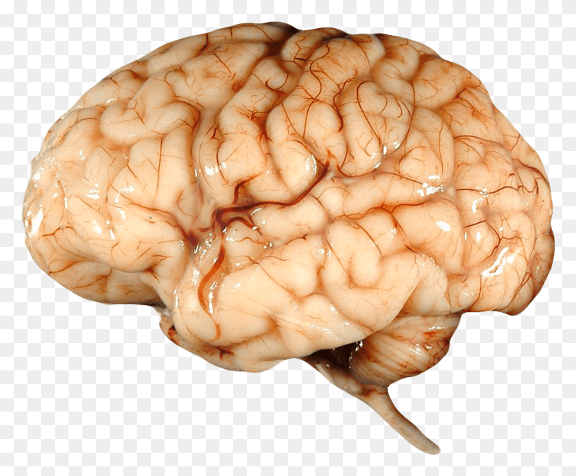 922x750 Real Brain Human Child Brain, Fungus, Accessories, Accessory HD PNG Download