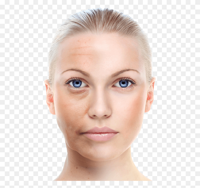 471x730 Remove Wrinkles Skin Whitening Cream In Nepal, Face, Person, Human HD PNG Download