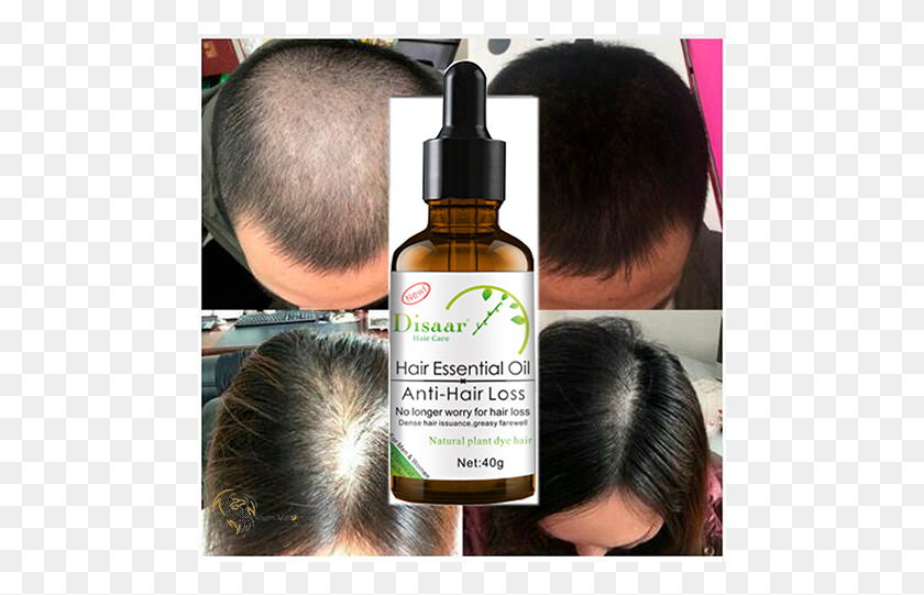 483x481 Repairs Follicles And Boosts Hair Growth Hair Growth Natural Hair Loss Treatment, Person, Human, Label HD PNG Download