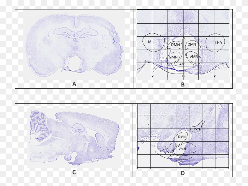 739x570 Representative Brain Sections Showing The Extent Of Drawing, Collage, Poster, Advertisement HD PNG Download