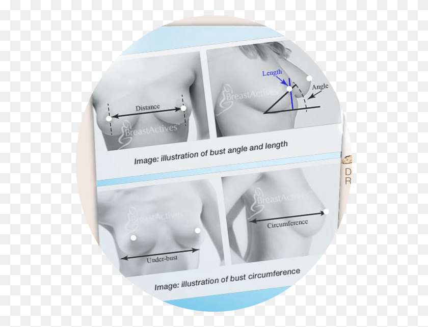 542x582 Researchers Have Shown And Proved That Many Women39s Do Boobs Stop Growing, X-ray, Ct Scan, Medical Imaging X-ray Film HD PNG Download