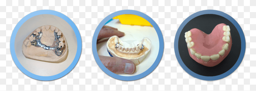 1130x350 Right Denture Tooth Denture Dish, Jaw, Teeth, Mouth HD PNG Download