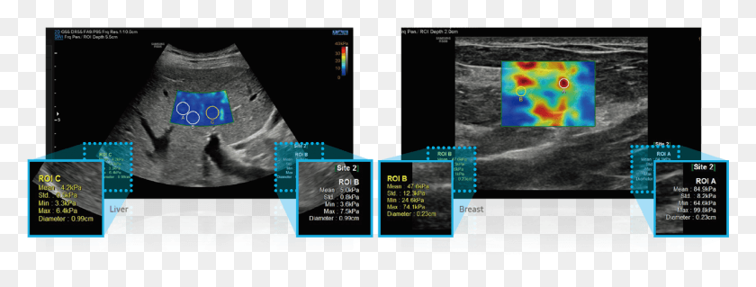 1241x413 S Shearwave Imaging Breast S Shearwave Samsung, Pac Man, Освещение, Экран Hd Png Скачать