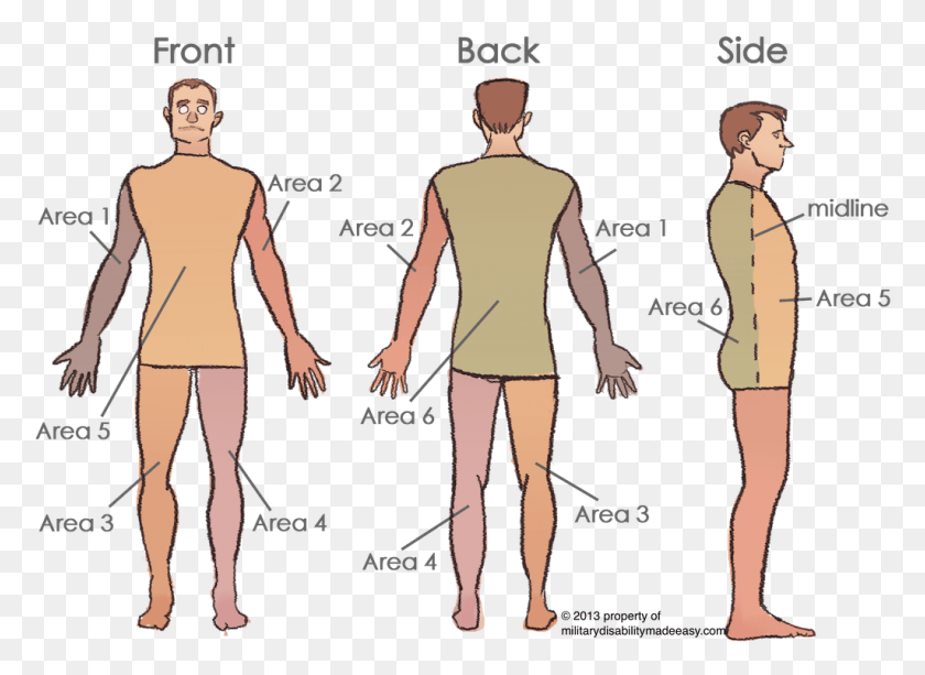 1024x726 Scar Areas 2 Torso Definition, Person, Human, Clothing HD PNG Download