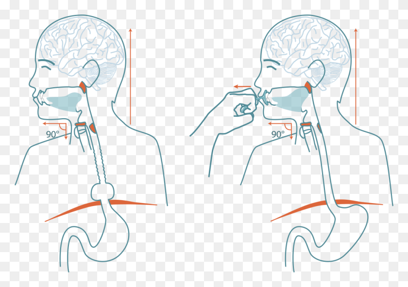 1024x699 See How The Upper Esophagus Sphincter Does Not Open Cartoon, Person, Human, Skeleton HD PNG Download