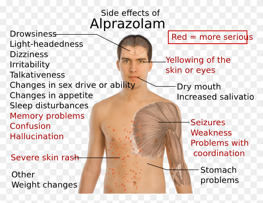 1488x1123 Side Effects Of Alprazolam Xanax Rash Side Effects, Person, Human, Clothing HD PNG Download