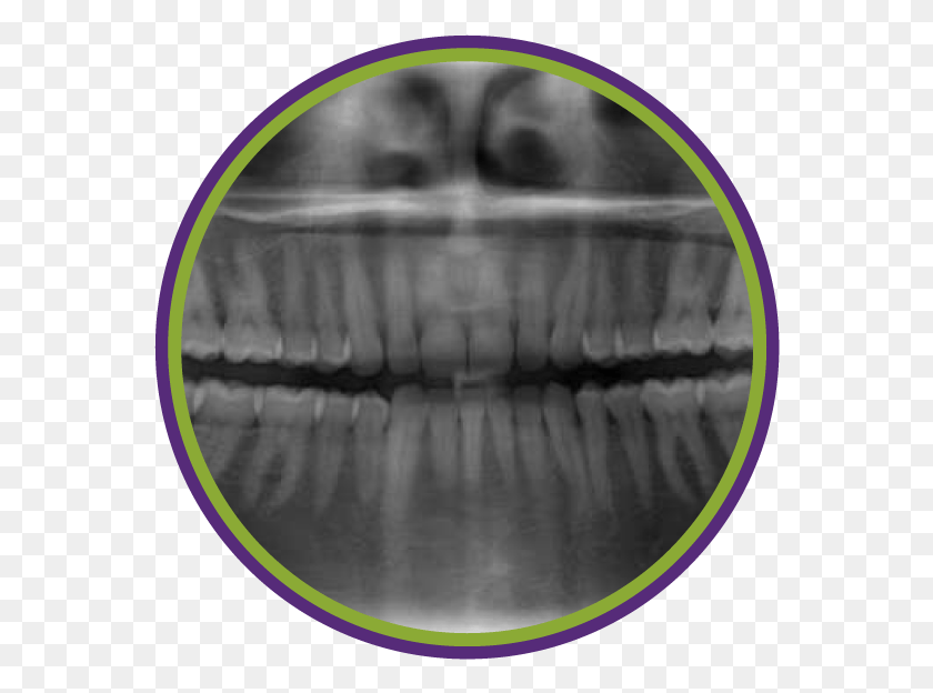564x564 Situation And Request X Rays Only When Necessary Based All Teeth X Ray, X-ray, Medical Imaging X-ray Film, Ct Scan HD PNG Download