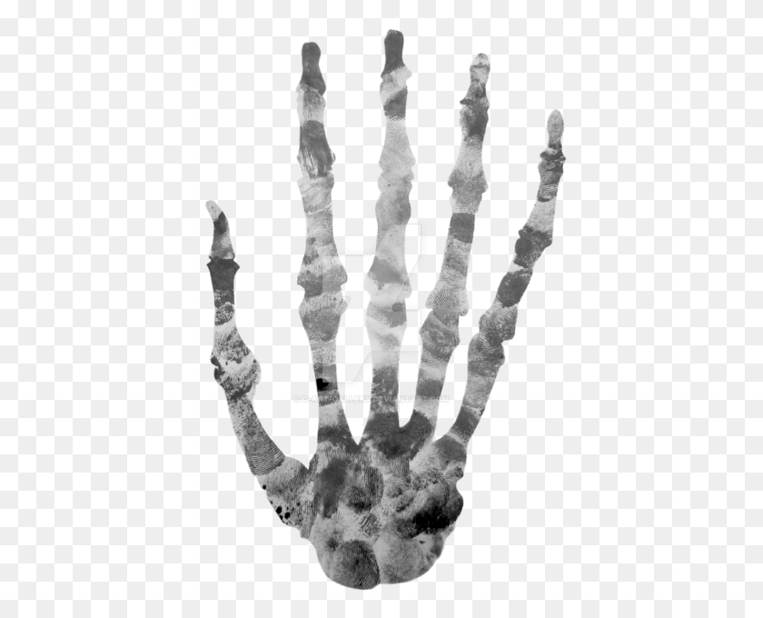 408x620 Скелет Руки Скелет Руки, Рентген, Рентгеновская Пленка Для Медицинской Визуализации, Компьютерное Сканирование Hd Png Скачать