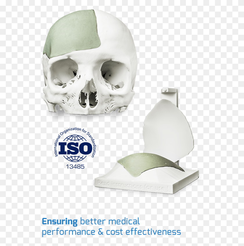 553x789 Skullpt Patient Specific Implant Technology Skull, Teeth, Mouth, Lip HD PNG Download