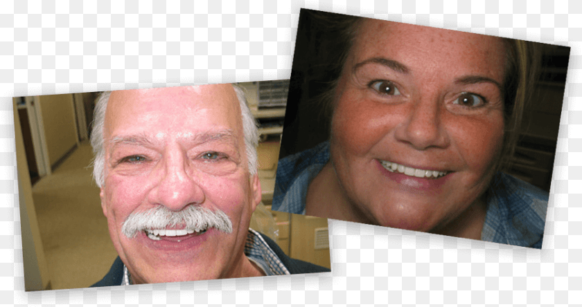 Smiling Patients Senior Citizen, Face, Person, Head, Art PNG