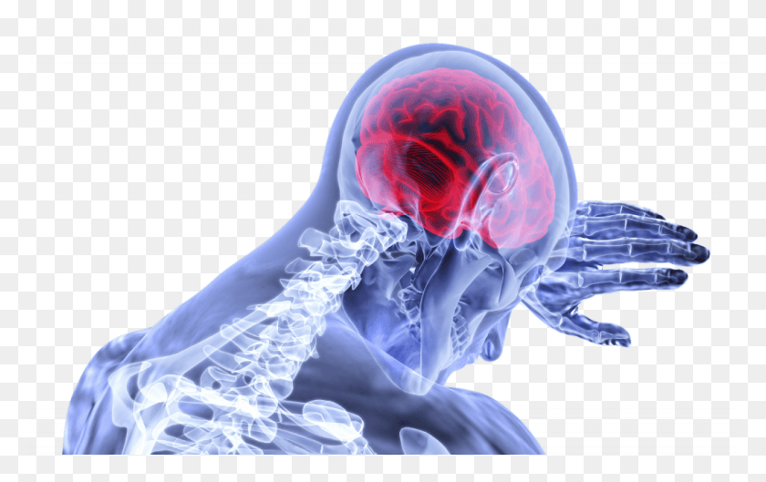 1024x617 Special Monthly Compensation Series Pain Brain, Person, Human, X-ray HD PNG Download