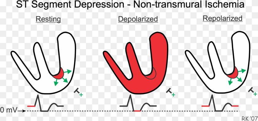 St Depression Model St Segment Elevation, Cutlery, Fork, Smoke Pipe Transparent PNG