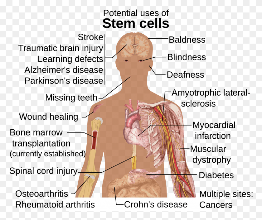 1572x1303 Stem Cell Background Potential Uses Of Stem Cells, Back, Neck, Person HD PNG Download