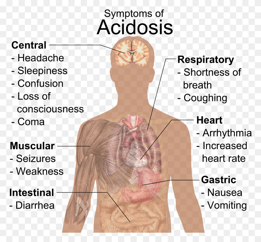 1976x1823 Symptoms Of Acidosis Importance Of Ph Value In Daily Life, Clothing, Apparel, Back HD PNG Download