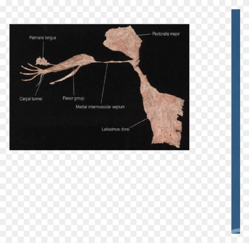 952x929 The Arm Lines Map, Soil, Fossil, Diagram Descargar Hd Png