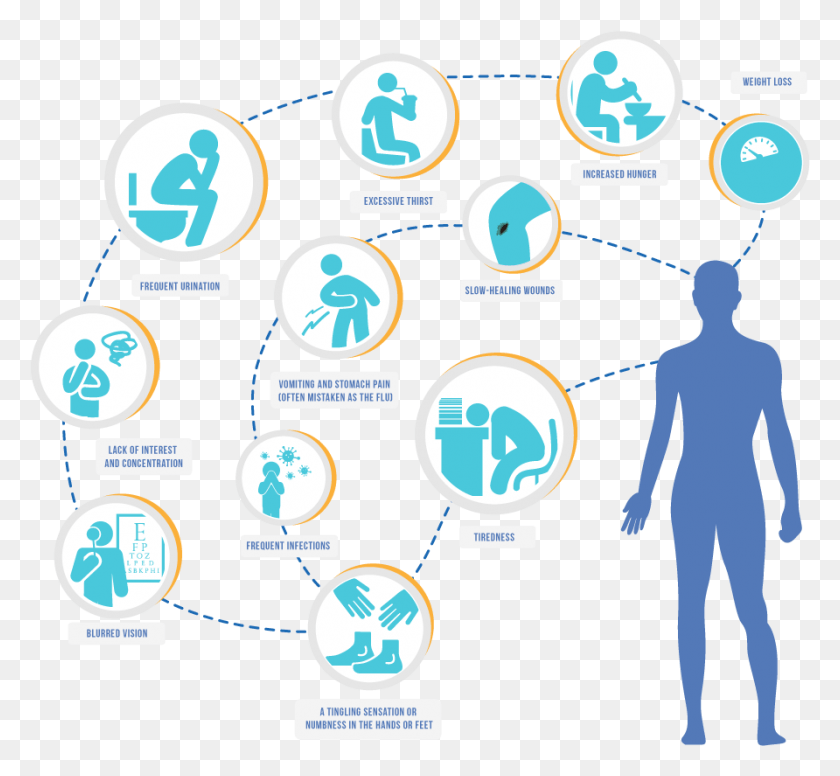 892x819 The Development Of Type 1 Diabetes Is Usually Sudden Symptoms Diabetes Type 2, Network, Sphere, Outer Space HD PNG Download