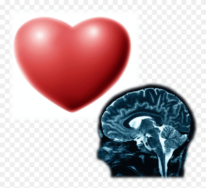 1005x909 The Heart Has Its Reasons Which Reason Knows Not Of Neuron Brain, X-ray, Medical Imaging X-ray Film, Ct Scan HD PNG Download