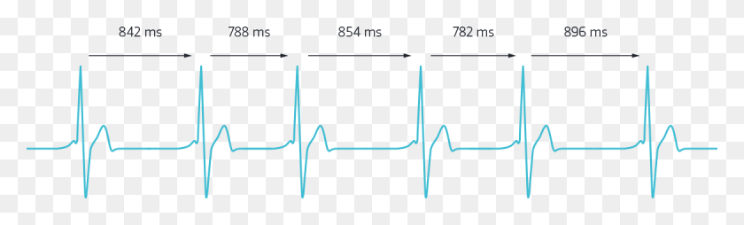 1170x291 The Medical School39s Article Notes How Each Individual39s Real Heart Rate Graph, Plot, Outdoors, Nature HD PNG Download