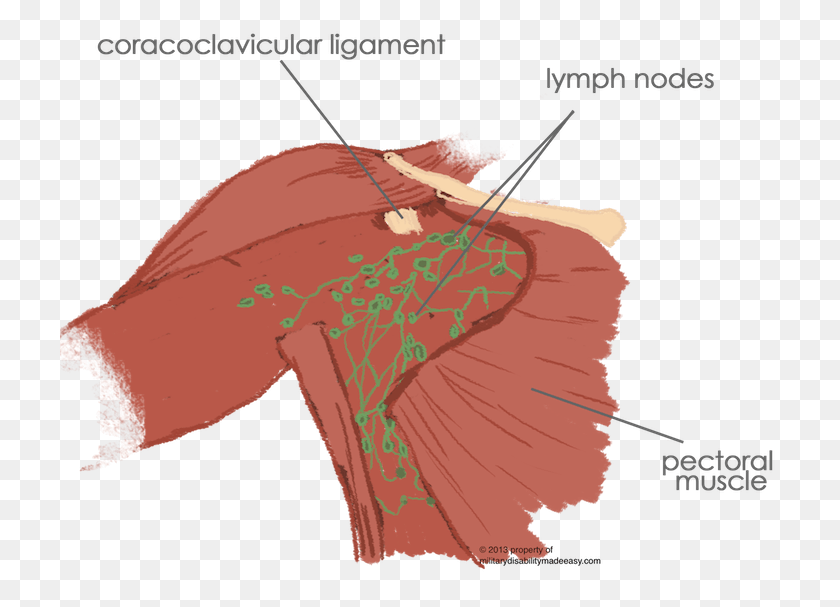720x547 The Removal Of The Breast From A Female Reproductive Muscle Connected To Breast, Plot, Tent, Diagram HD PNG Download