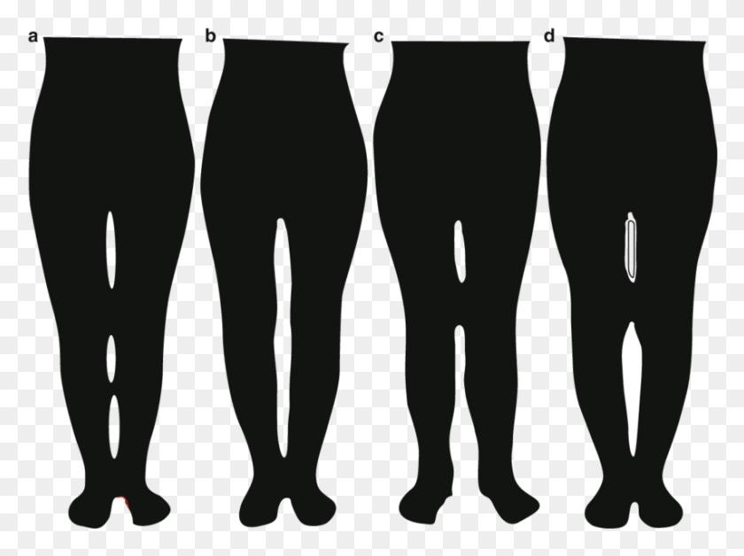 851x620 The Shape Of The Lower Extremities Is Determined Legs Shape, Cat, Pet, Mammal HD PNG Download