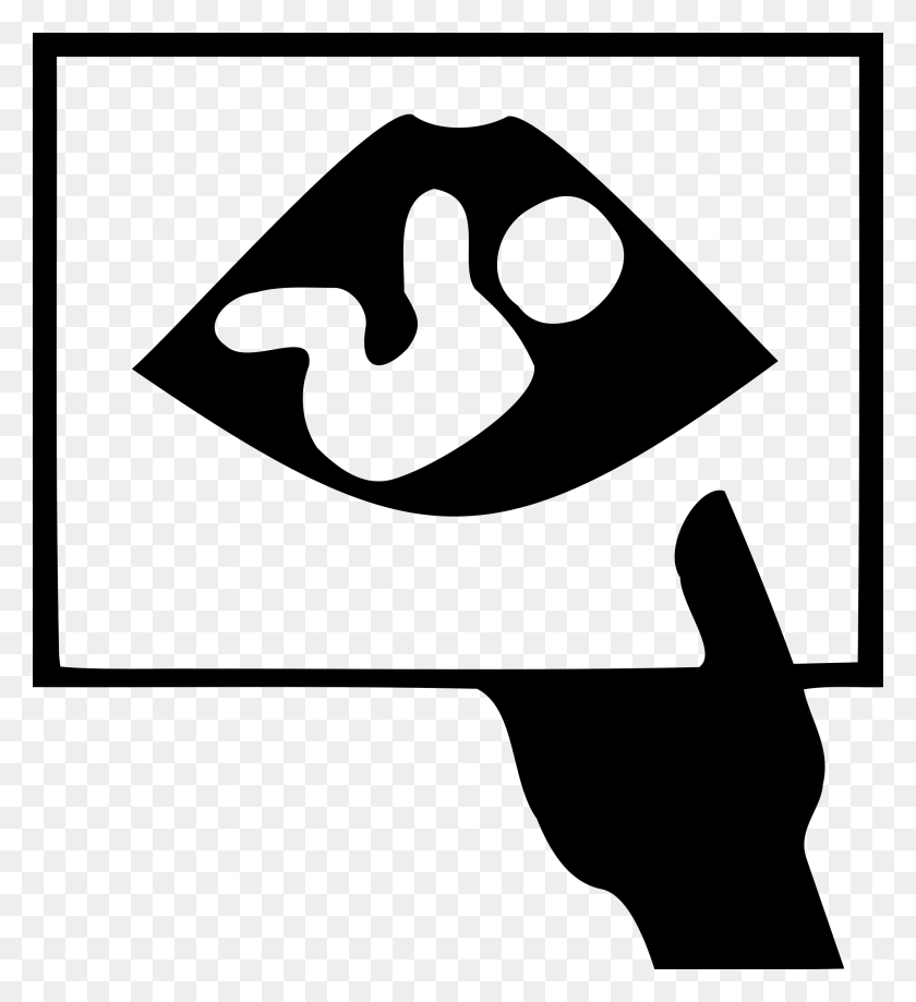 2177x2400 This Free Icons Design Of Ultrasound Picture Of Baby In Womb Clipart, Gray, World Of Warcraft Hd Png