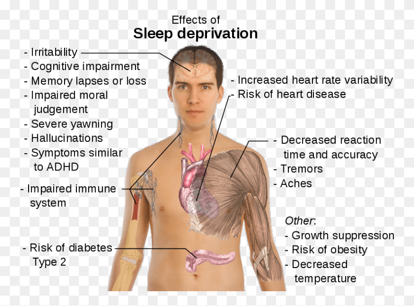 760x561 This Guide Gets At The Link Between Anxiety And Sleep Long Can You Go Without Sleep, Person, Human, Clothing HD PNG Download