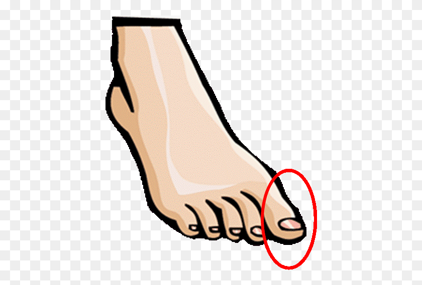 422x509 Toe, Ankle, Hand, Heel HD PNG Download